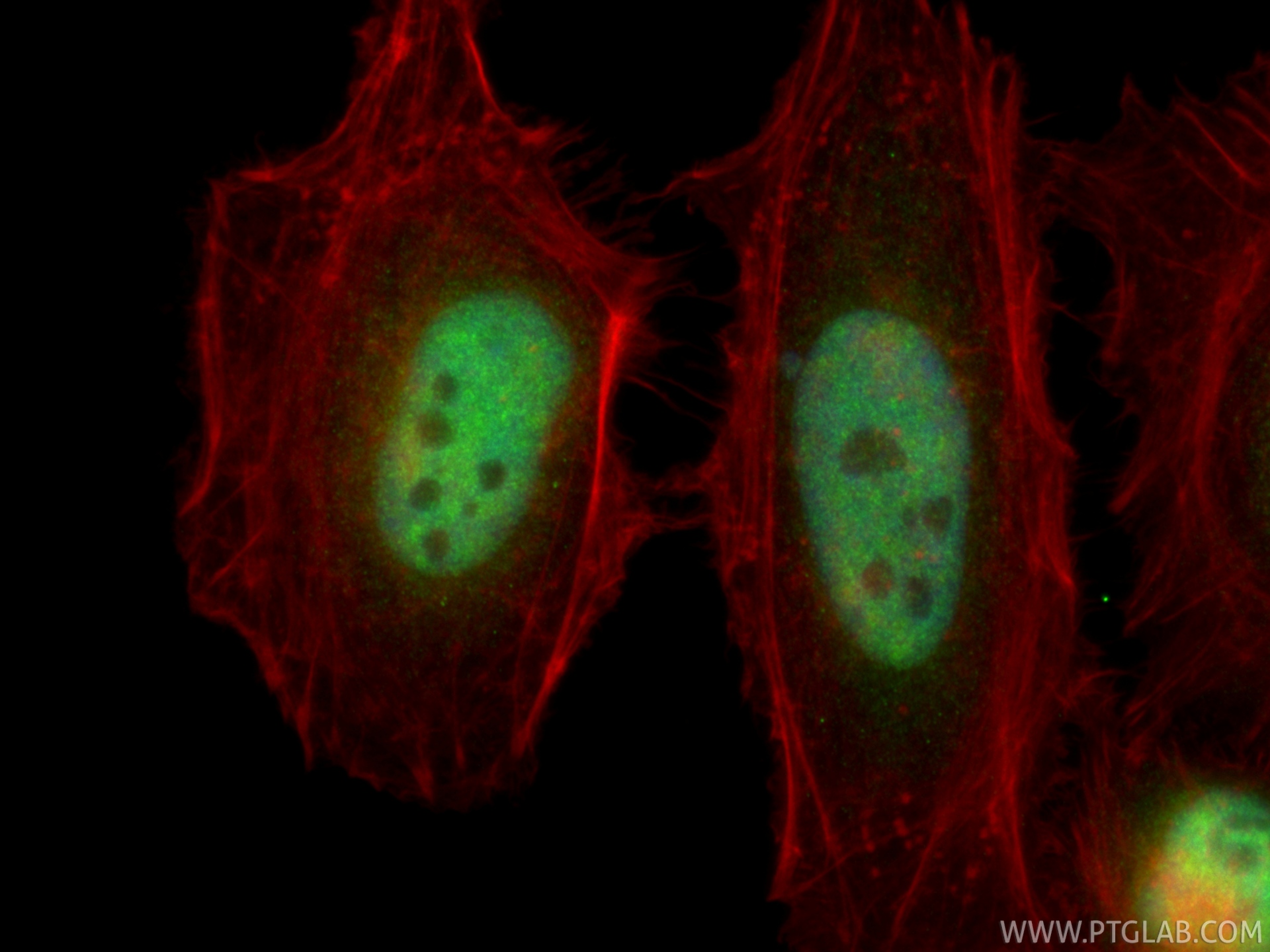IF Staining of HeLa using 15581-1-AP IF Staining of HeLa using 15581-1-AP