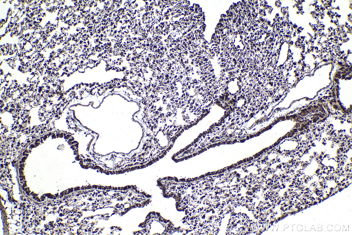 IHC staining of mouse lung using 26638-1-AP IHC staining of mouse lung using 26638-1-AP