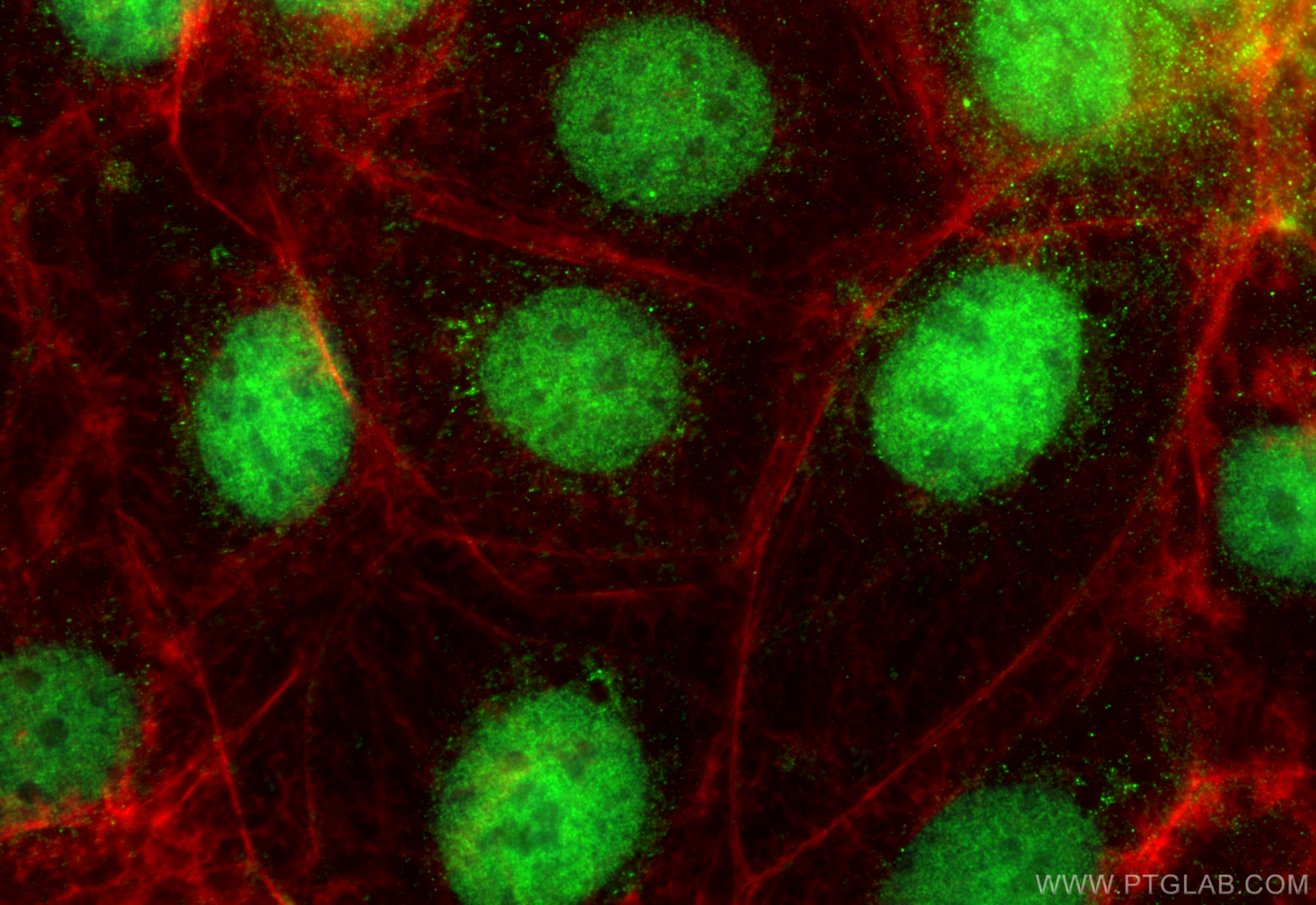Immunofluorescent analysis of (4% PFA) fixed Caco-2 cells using PCIF1 antibody (16082-1-AP) at dilution of 1:400 and CoraLite®488-Conjugated Goat Anti-Rabbit IgG(H+L) (<a class='green' href='/productredirect?CatalogNo=SA00013-2' target='_blank'>SA00013-2</a>), CL594-Phalloidin (red). IF Staining of Caco-2 using 16082-1-AP
