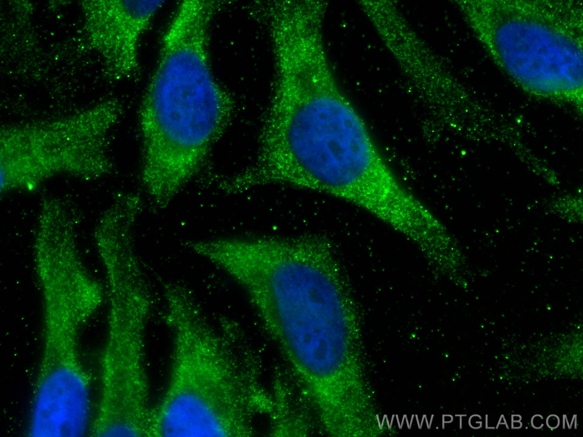 IF Staining of HeLa using 66862-1-Ig (same clone as 66862-1-PBS)