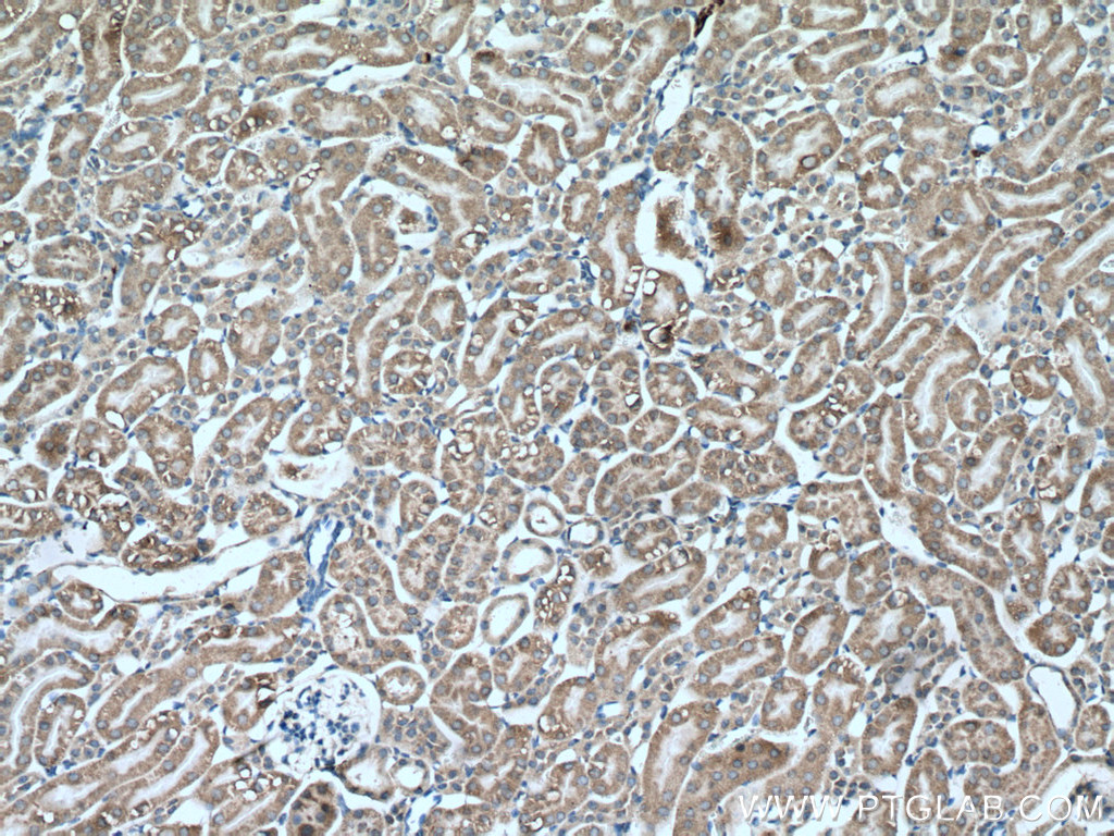 IHC staining of mouse kidney using 66862-1-Ig (same clone as 66862-1-PBS)