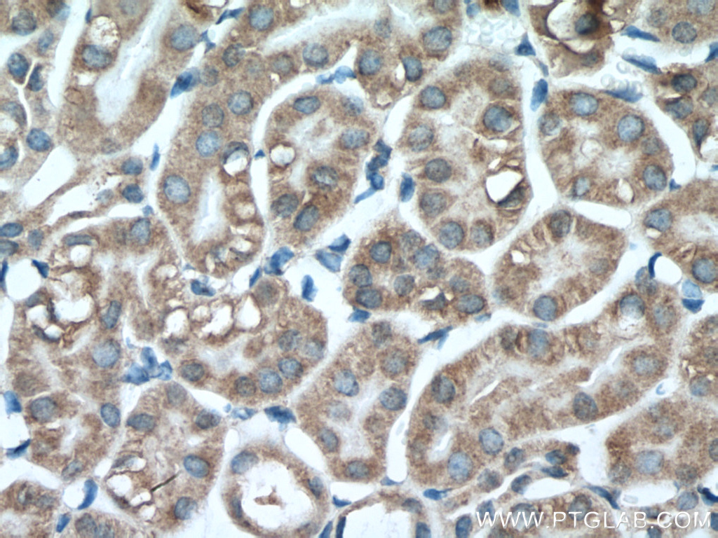 IHC staining of mouse kidney using 66862-1-Ig (same clone as 66862-1-PBS)