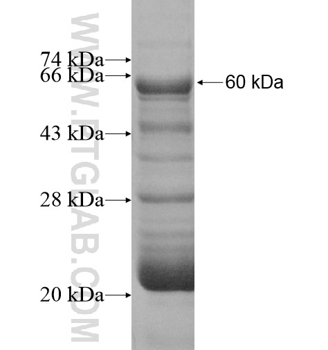 PCK1 fusion protein Ag10261 SDS-PAGE