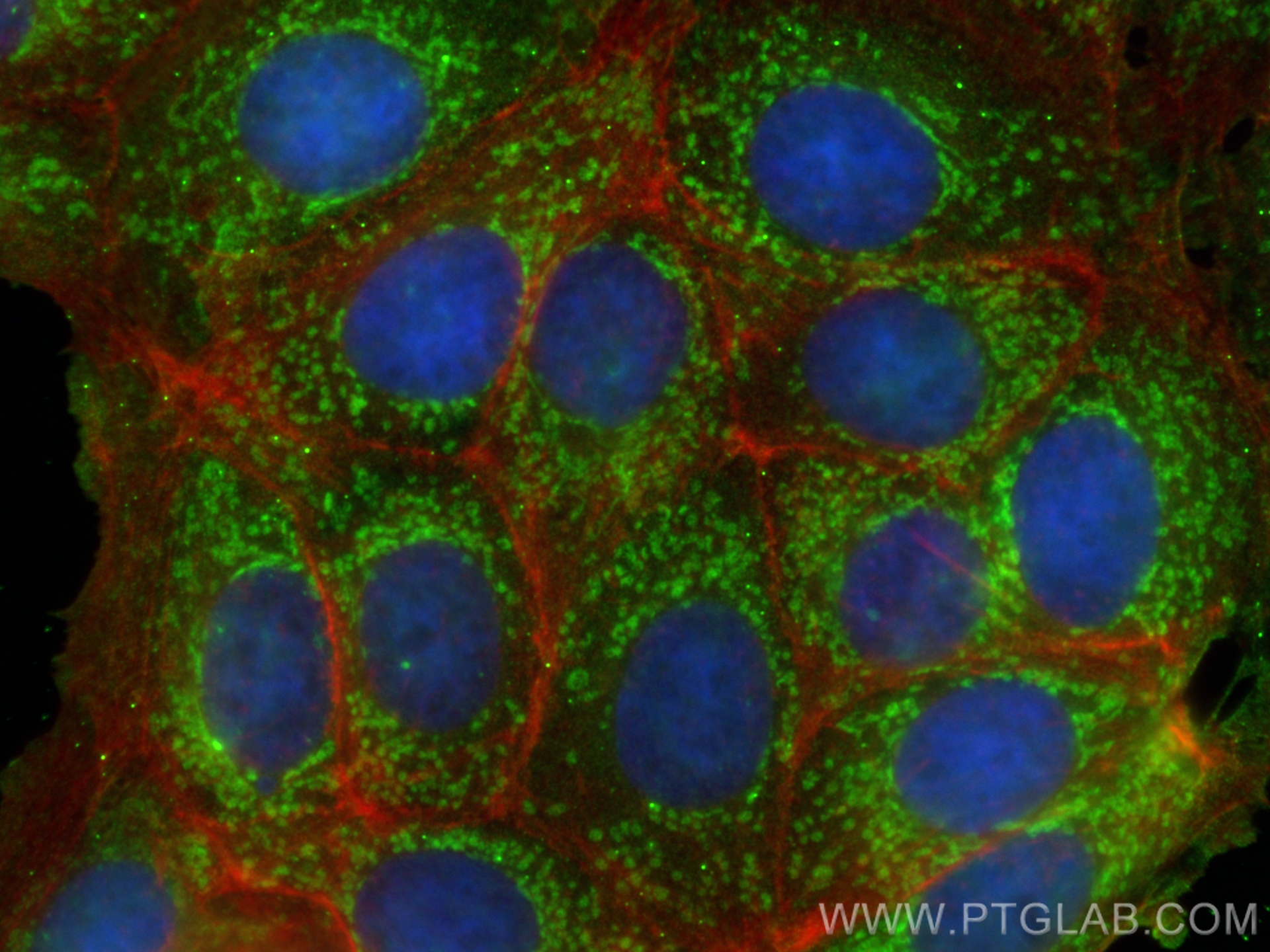 IF Staining of MCF-7 using 67676-1-Ig