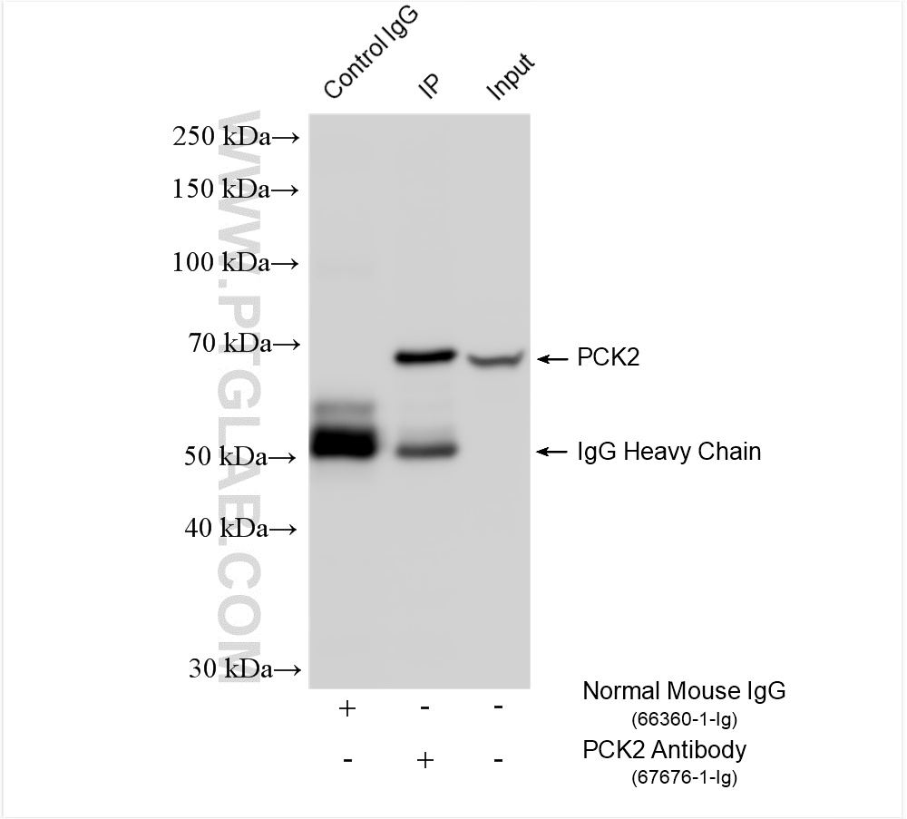 IP experiment of HepG2 using 67676-1-Ig