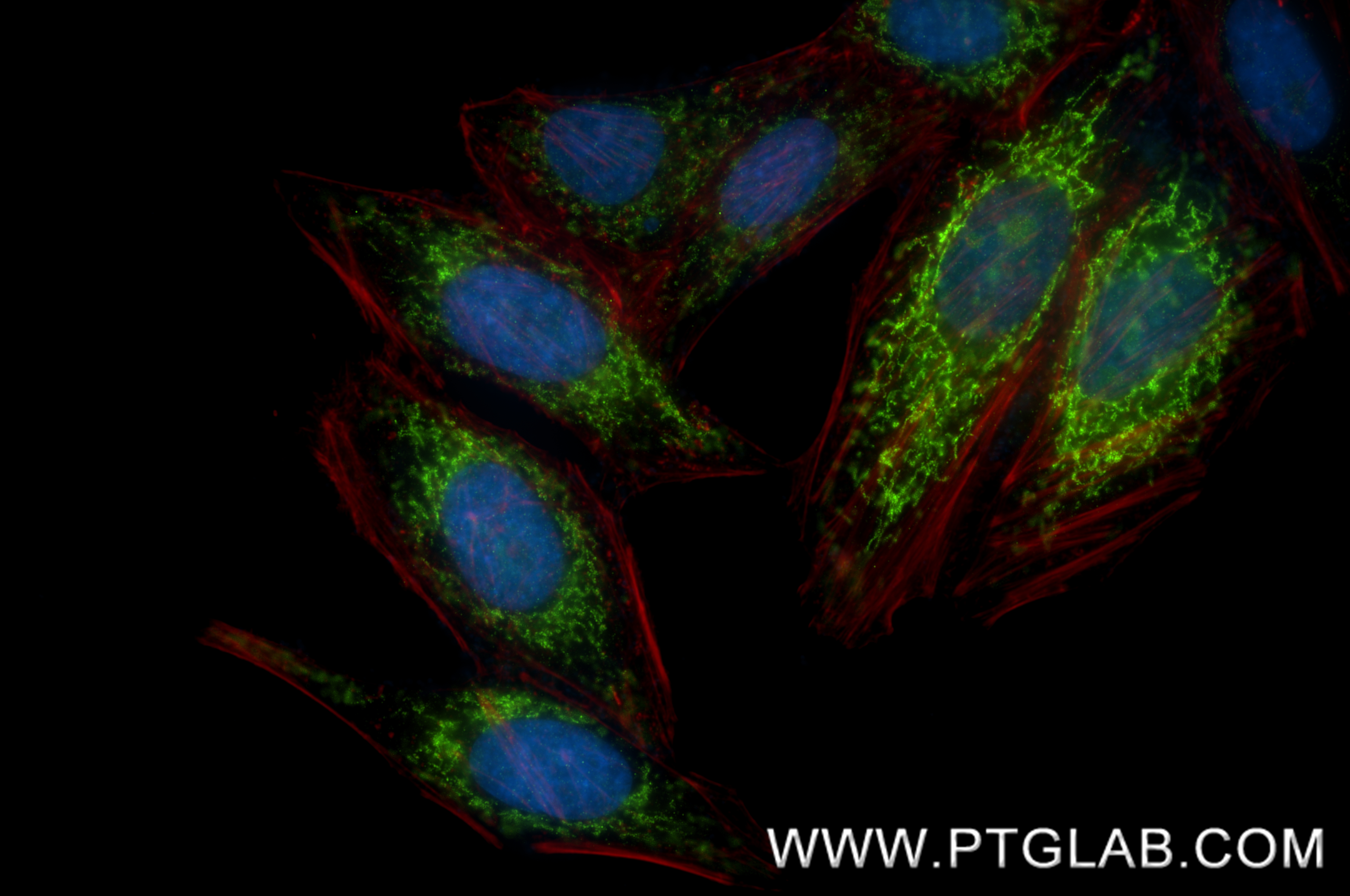 IF Staining of HepG2 using 88027-1-RR IF Staining of HepG2 using 88027-1-RR