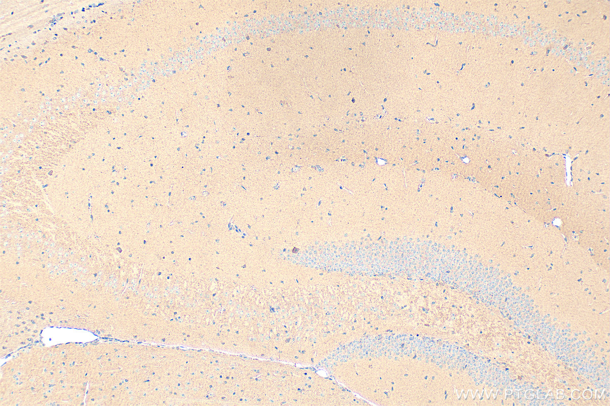 IHC staining of mouse brain using 18156-1-AP