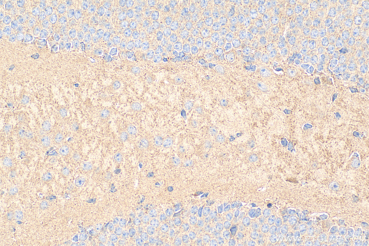 IHC staining of mouse brain using 18156-1-AP