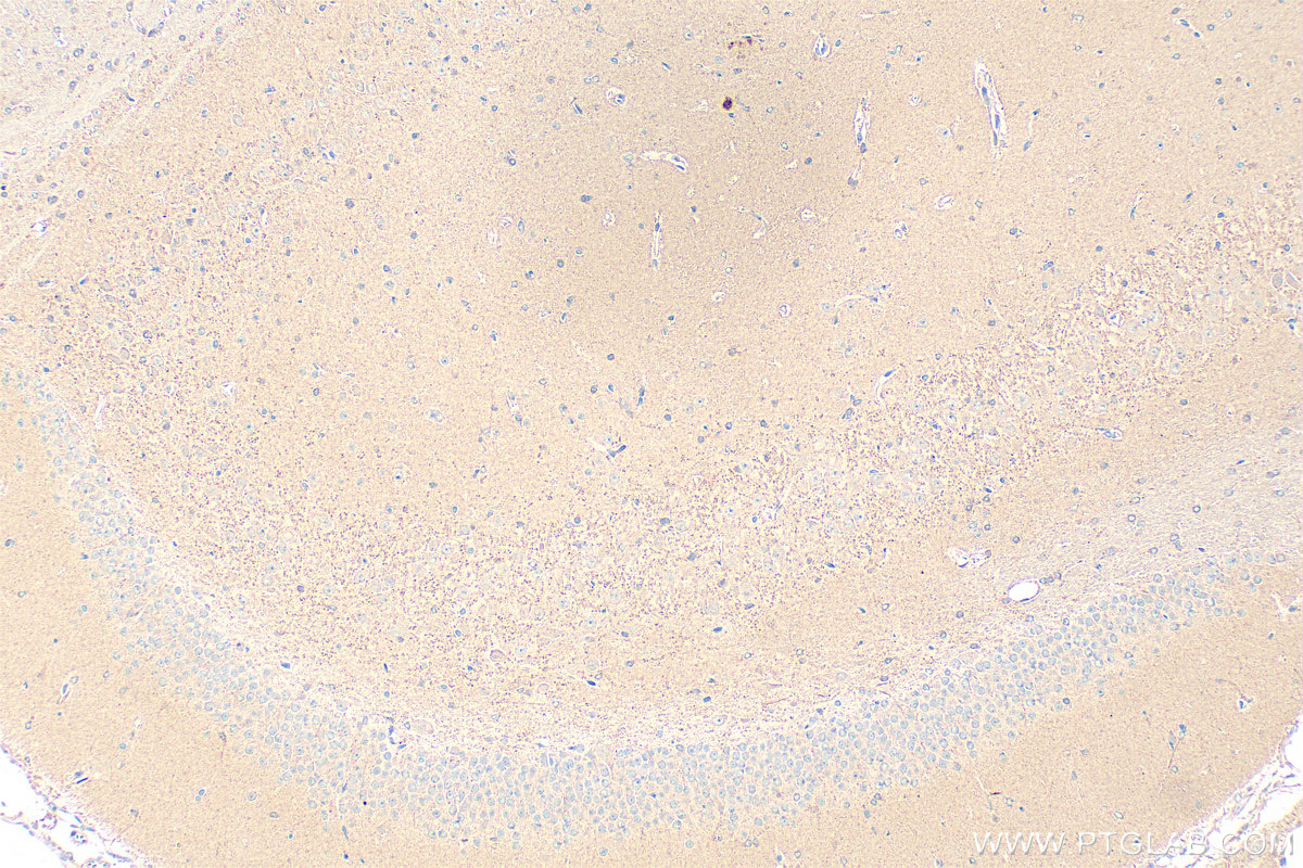 IHC staining of rat brain using 18156-1-AP