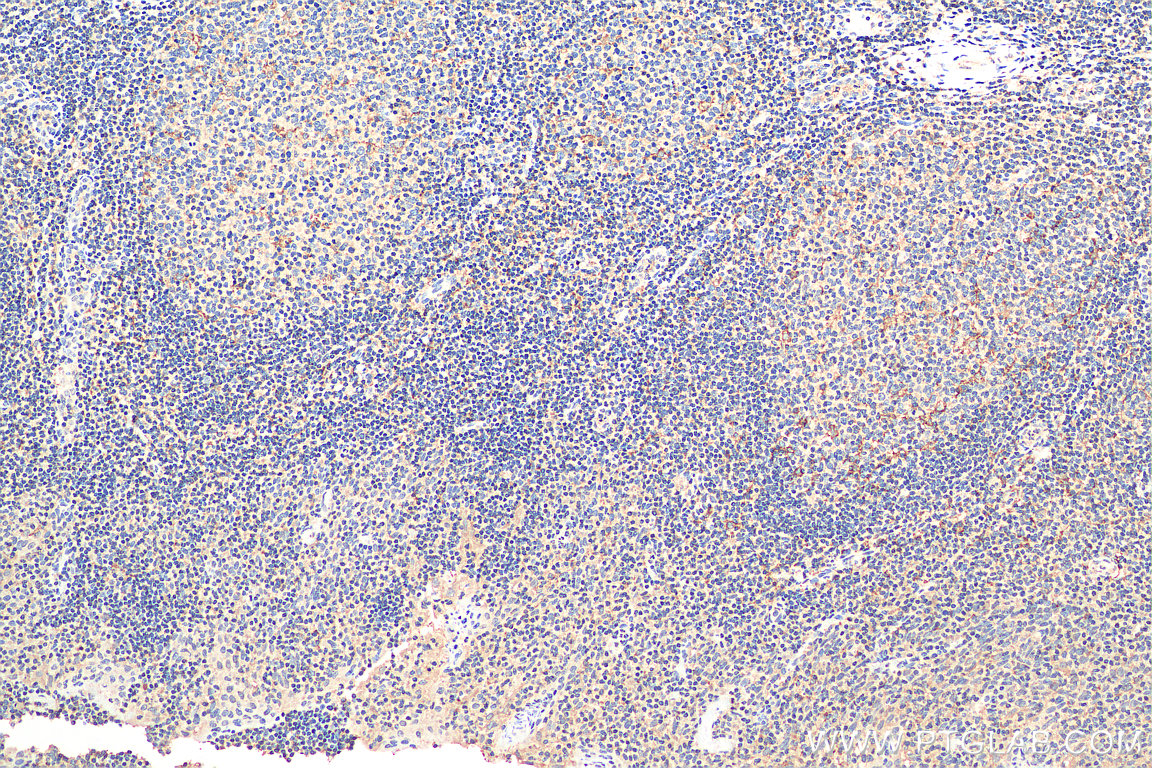 IHC staining of human tonsillitis using 19856-1-AP