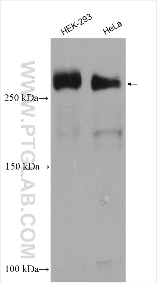 WB analysis using 19856-1-AP