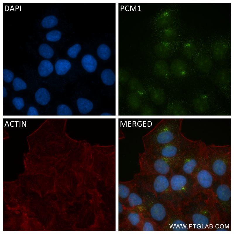 IF Staining of HepG2 using 84979-2-RR (same clone as 84979-2-PBS)