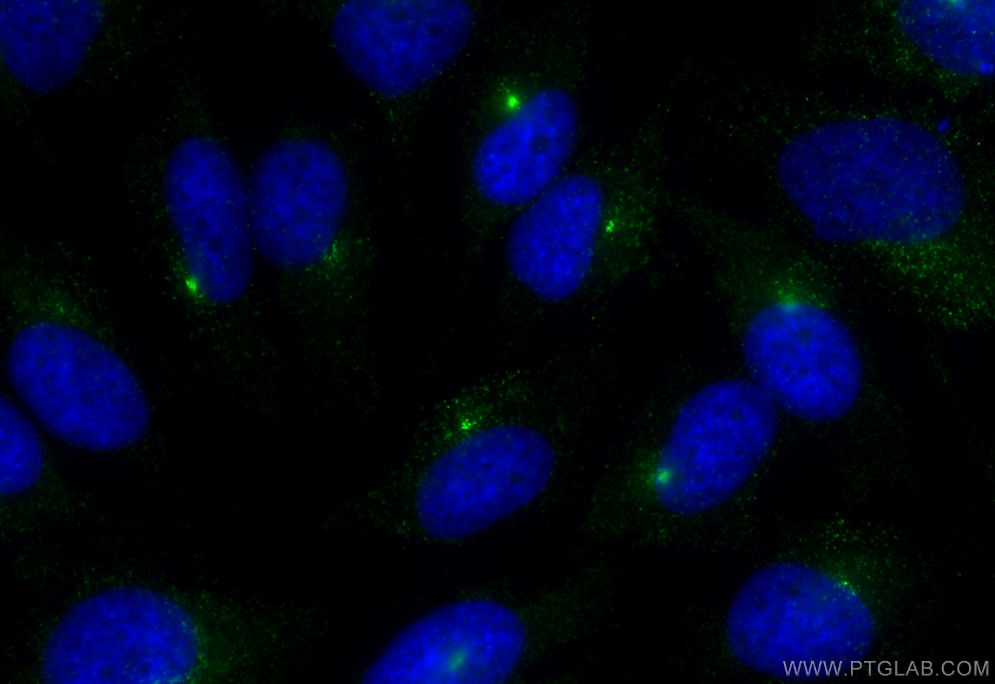 IF Staining of HeLa using 84979-2-RR (same clone as 84979-2-PBS)