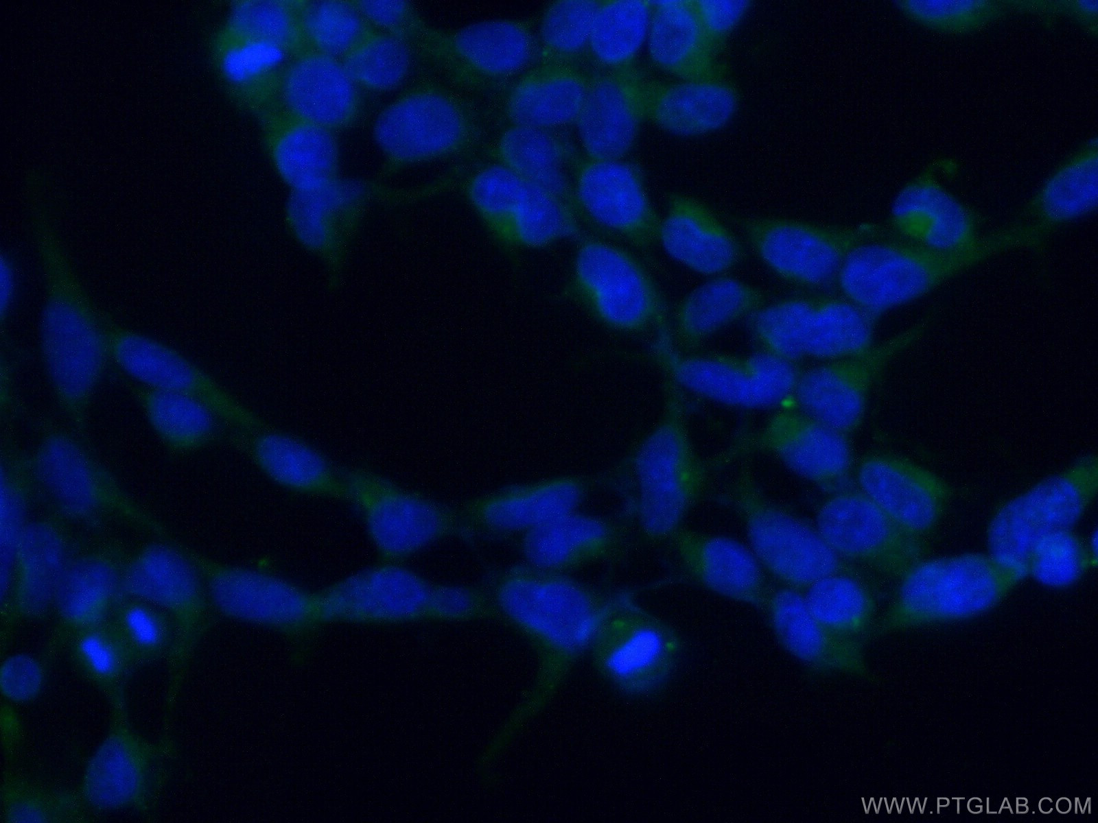 IF Staining of HEK-293 using 10519-1-AP