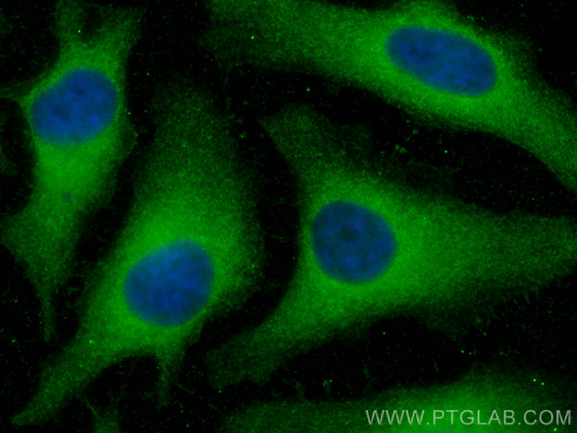 IF Staining of HeLa using 60172-1-Ig (same clone as 60172-1-PBS)