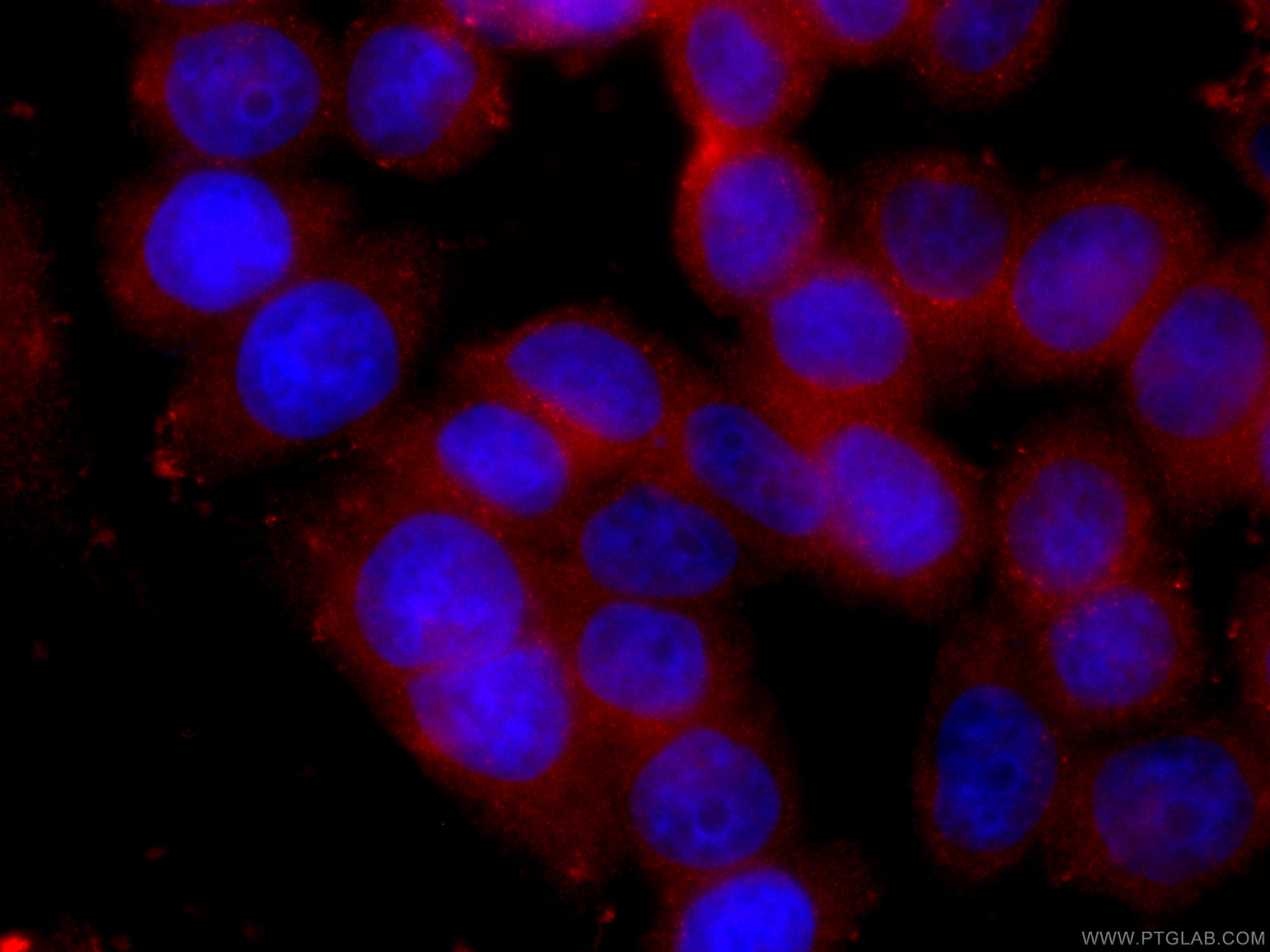 IF Staining of HeLa using CL594-60172