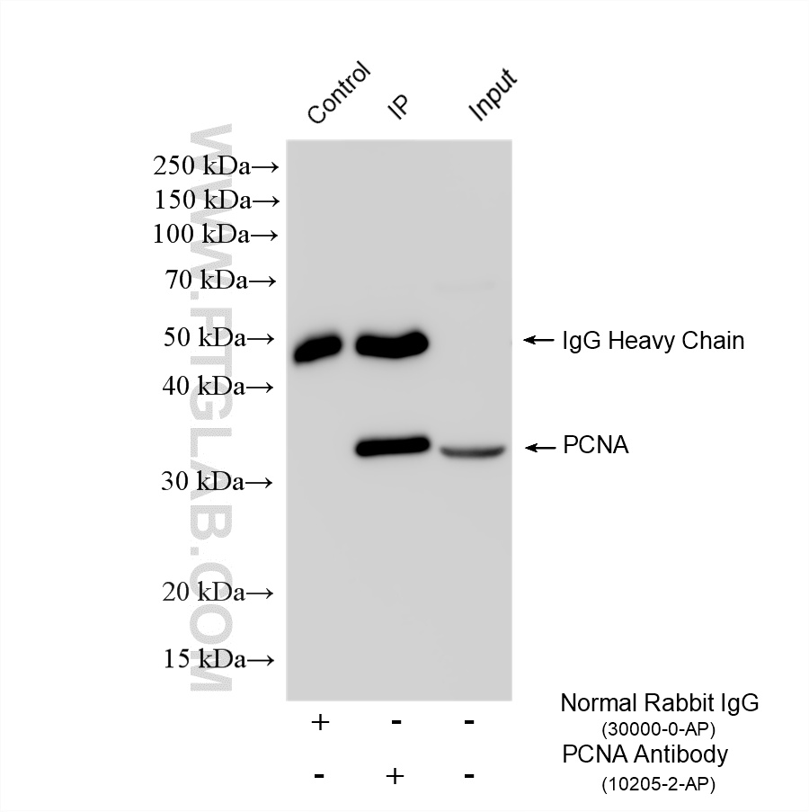 IP experiment of HeLa using 10205-2-AP