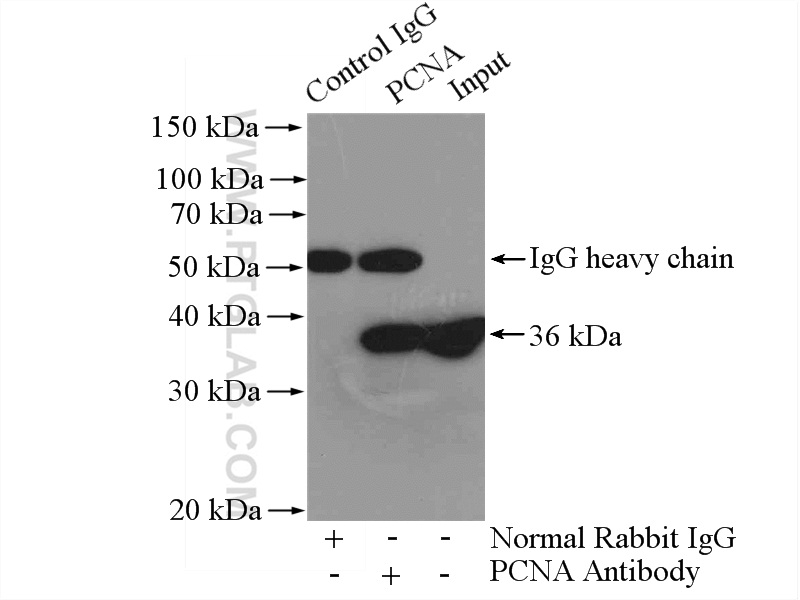 IP experiment of HEK-293 using 24036-1-AP