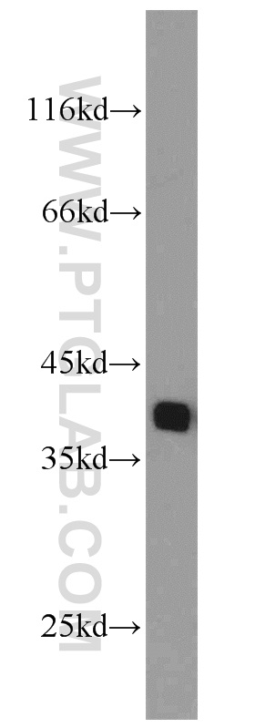 WB analysis of HEK-293 using 24036-1-AP