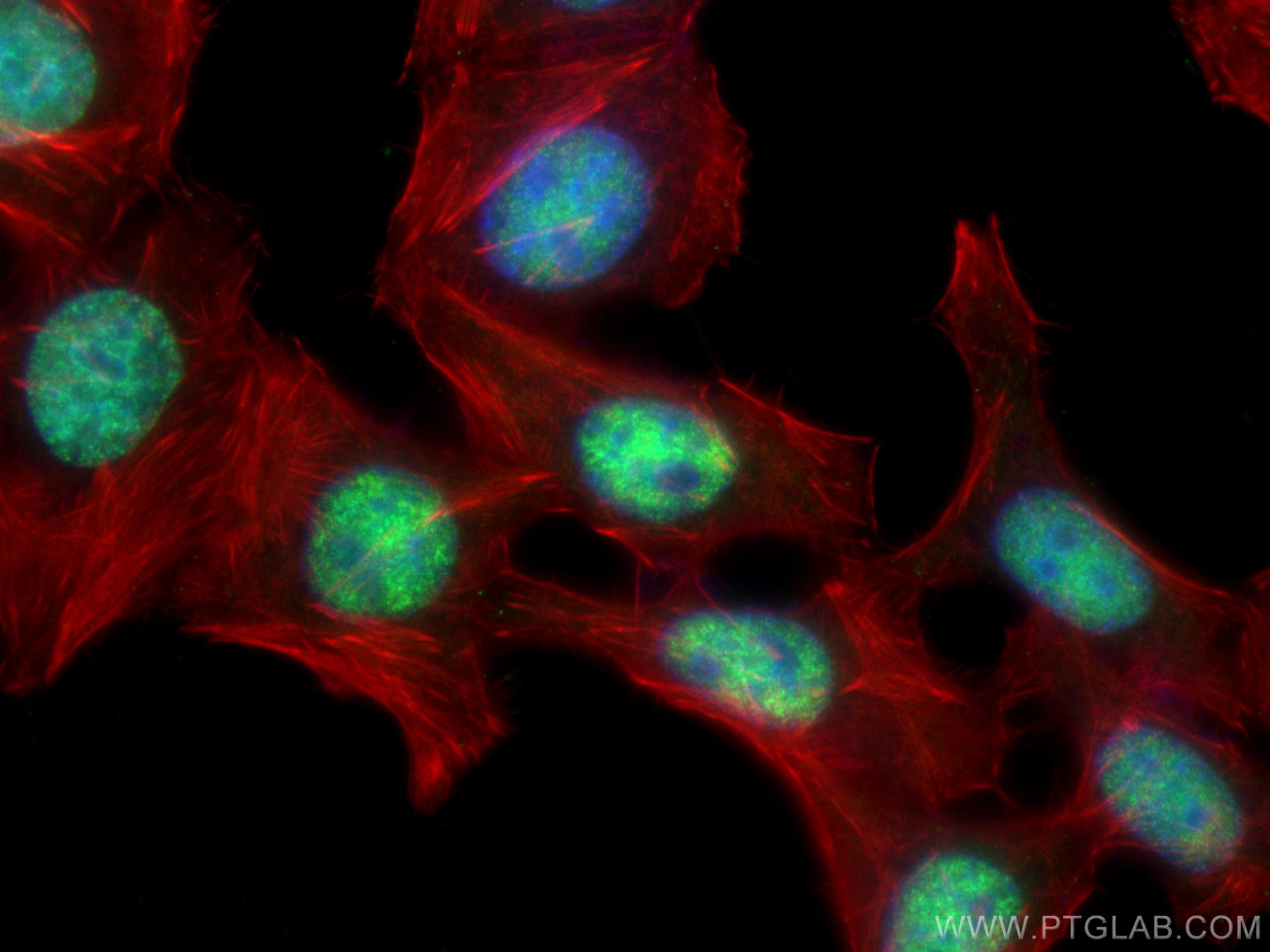 IF Staining of HepG2 using 60097-1-Ig (same clone as 60097-1-PBS)