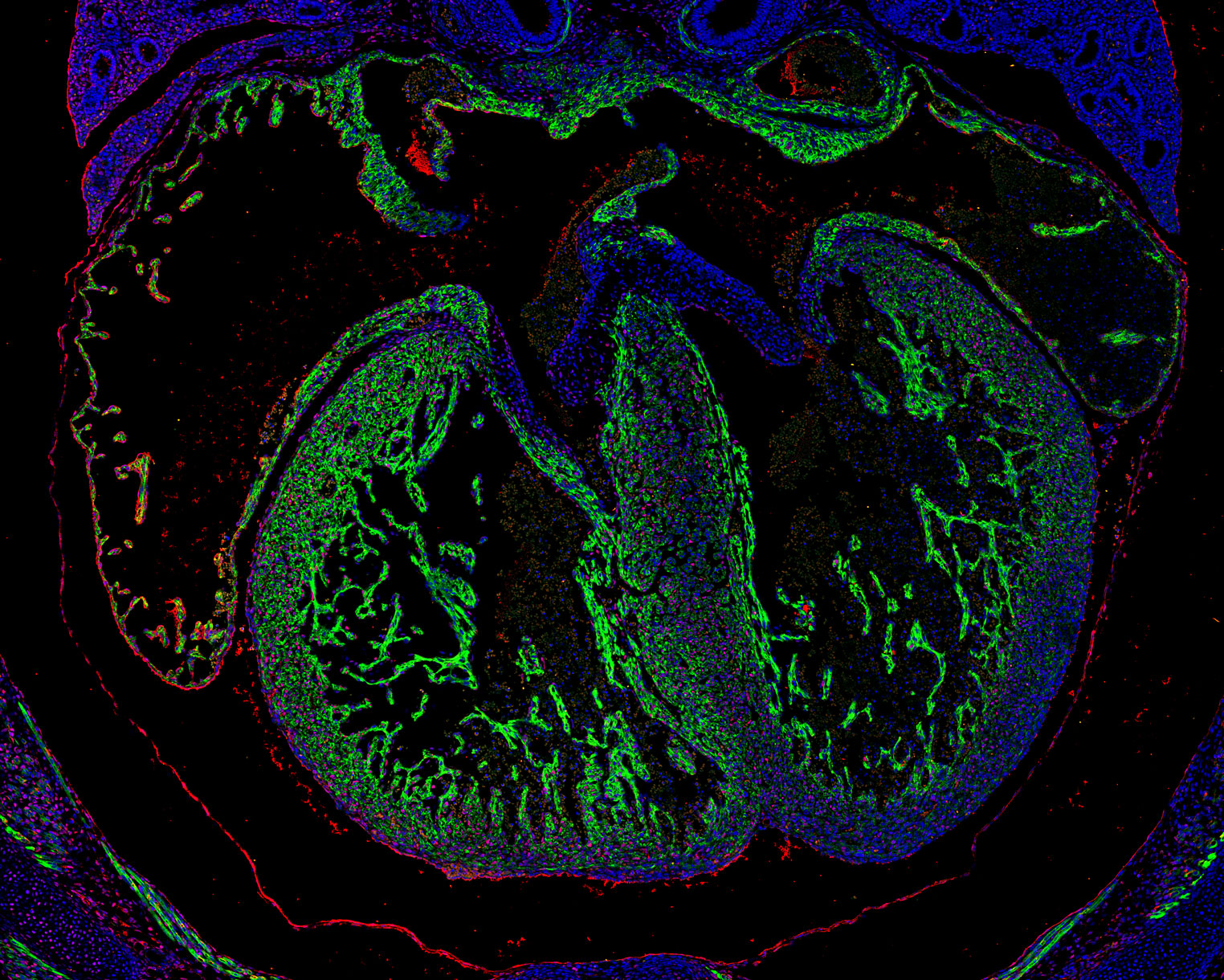 IF Staining of mouse heart using 60097-1-Ig (same clone as 60097-1-PBS)