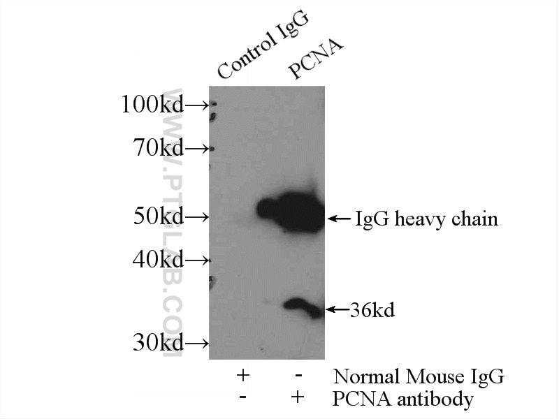 IP experiment of HepG2 using 60097-1-Ig (same clone as 60097-1-PBS)