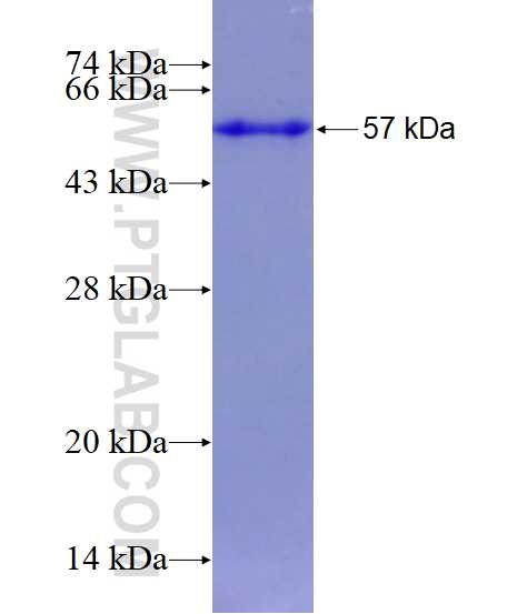 PCNA fusion protein Ag0277 SDS-PAGE