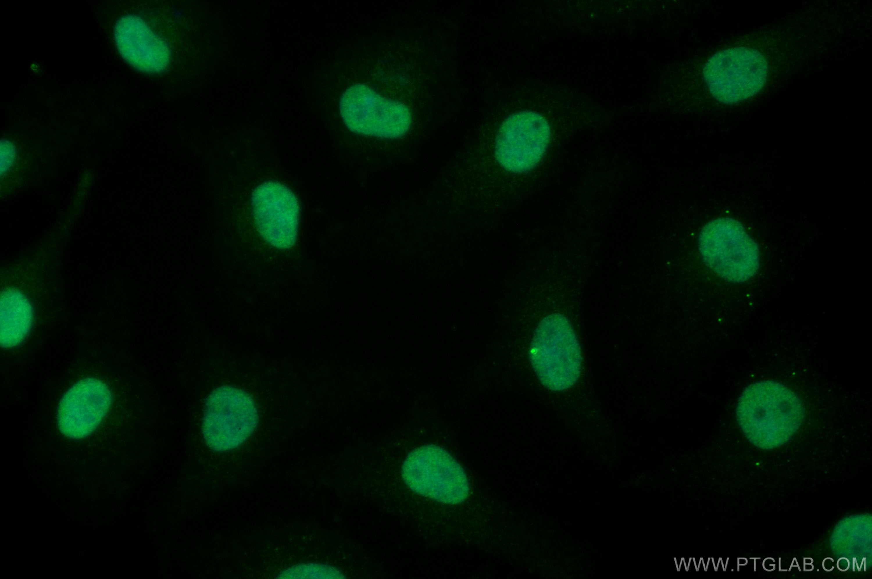 IF Staining of HeLa using 11180-2-AP