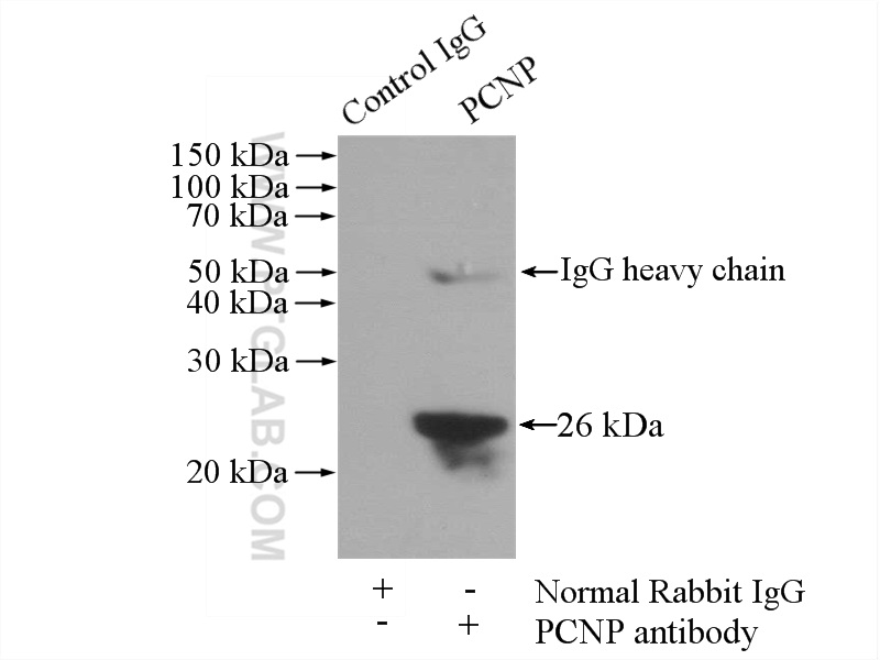 IP experiment of HepG2 using 11180-2-AP