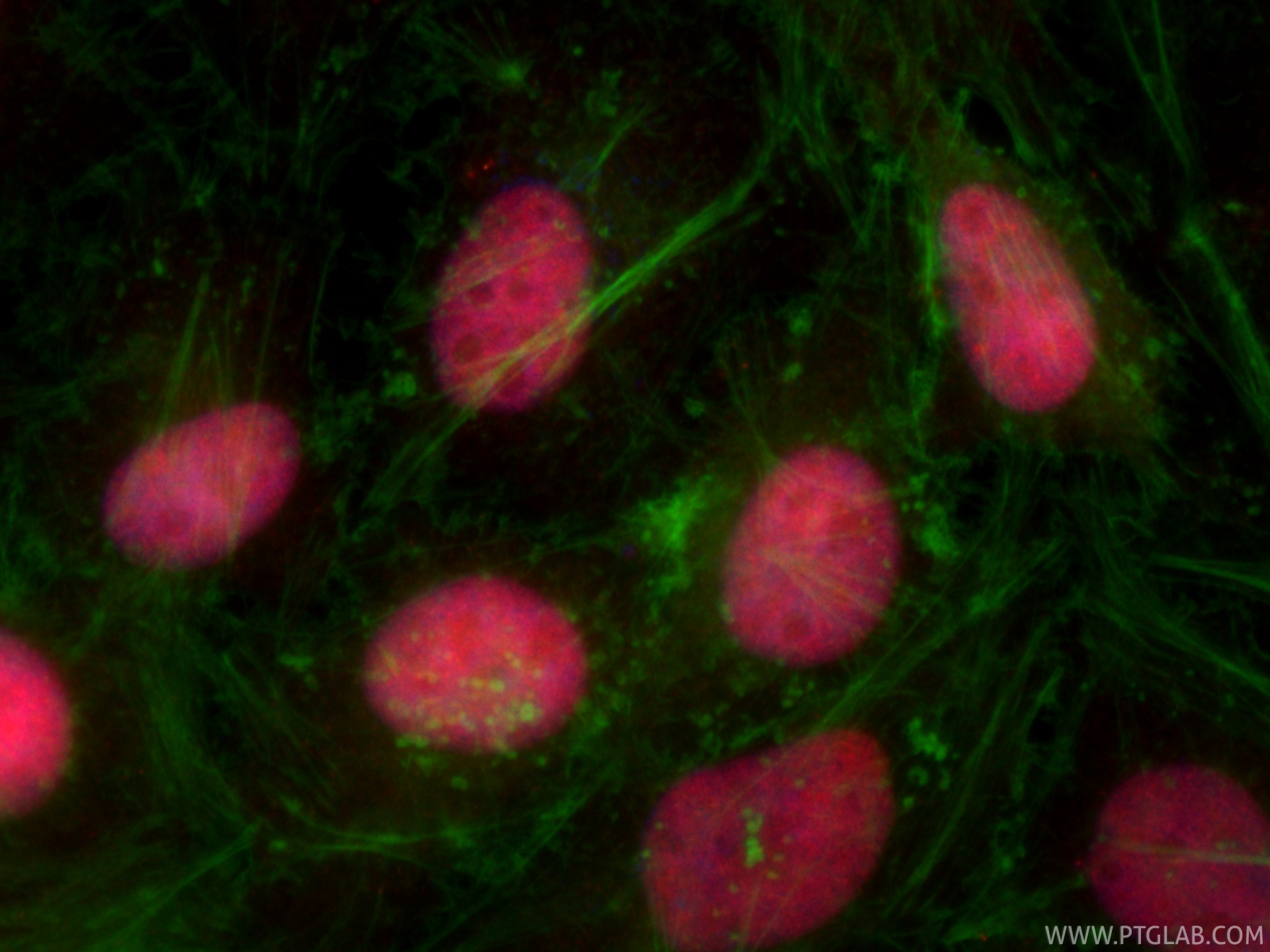 IF Staining of HeLa using CL594-86075