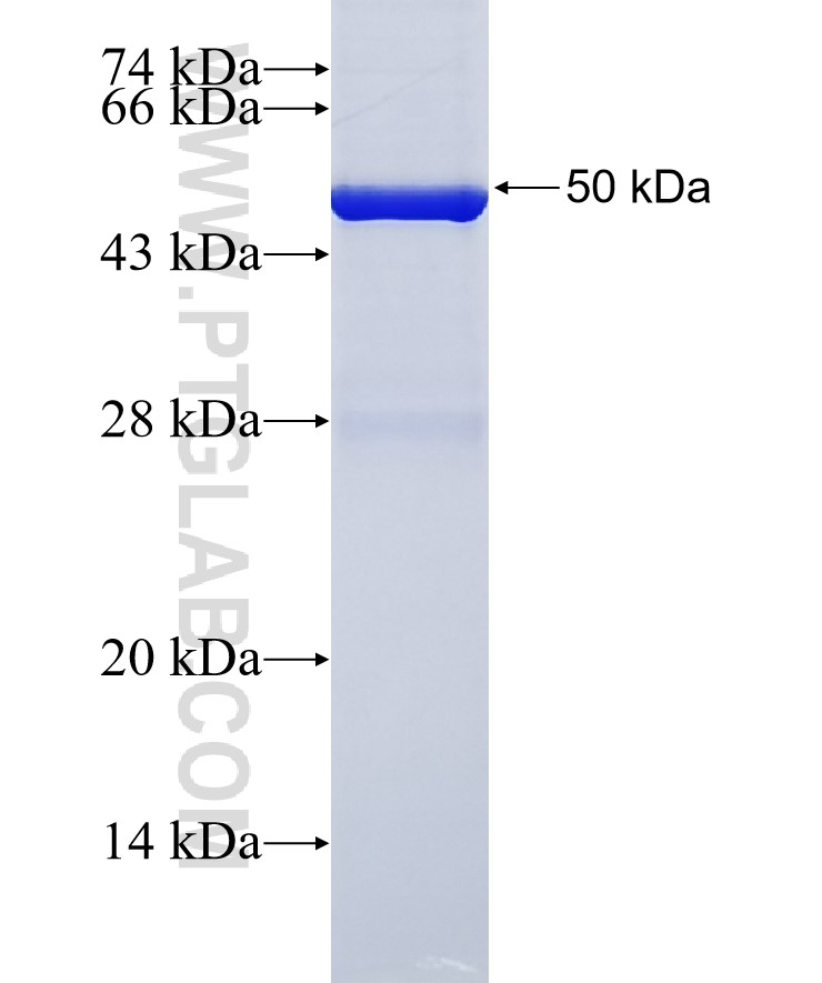 PCNX fusion protein Ag37954 SDS-PAGE PCNX fusion protein Ag37954 SDS-PAGE