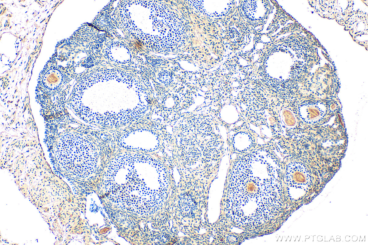 Immunohistochemical analysis of paraffin-embedded mouse ovary tissue slide using 14993-1-AP (PCOLCE antibody) at dilution of 1:400 (under 10x lens). Heat mediated antigen retrieval with Tris-EDTA buffer (pH 9.0). IHC staining of mouse ovary using 14993-1-AP