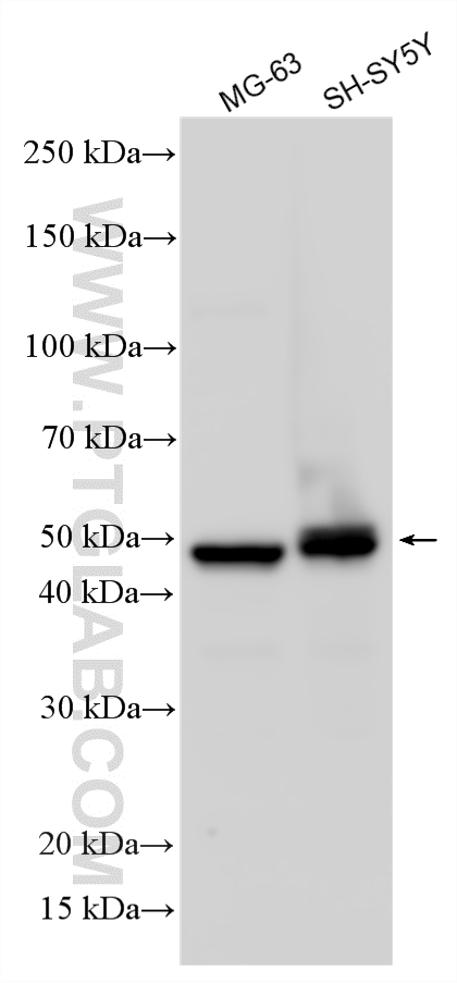Various lysates were subjected to SDS PAGE followed by western blot with 14993-1-AP (PCOLCE antibody) at dilution of 1:3000 incubated at room temperature for 1.5 hours. WB analysis using 14993-1-AP
