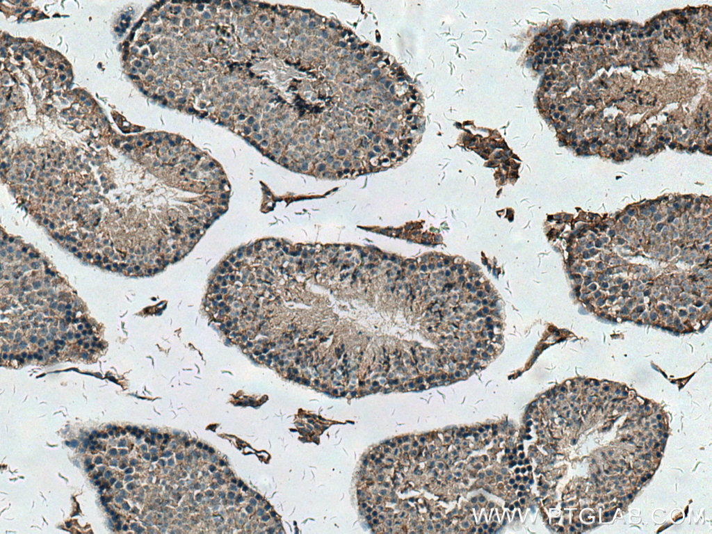 IHC staining of mouse testis using 24564-1-AP (same clone as 24564-1-PBS)