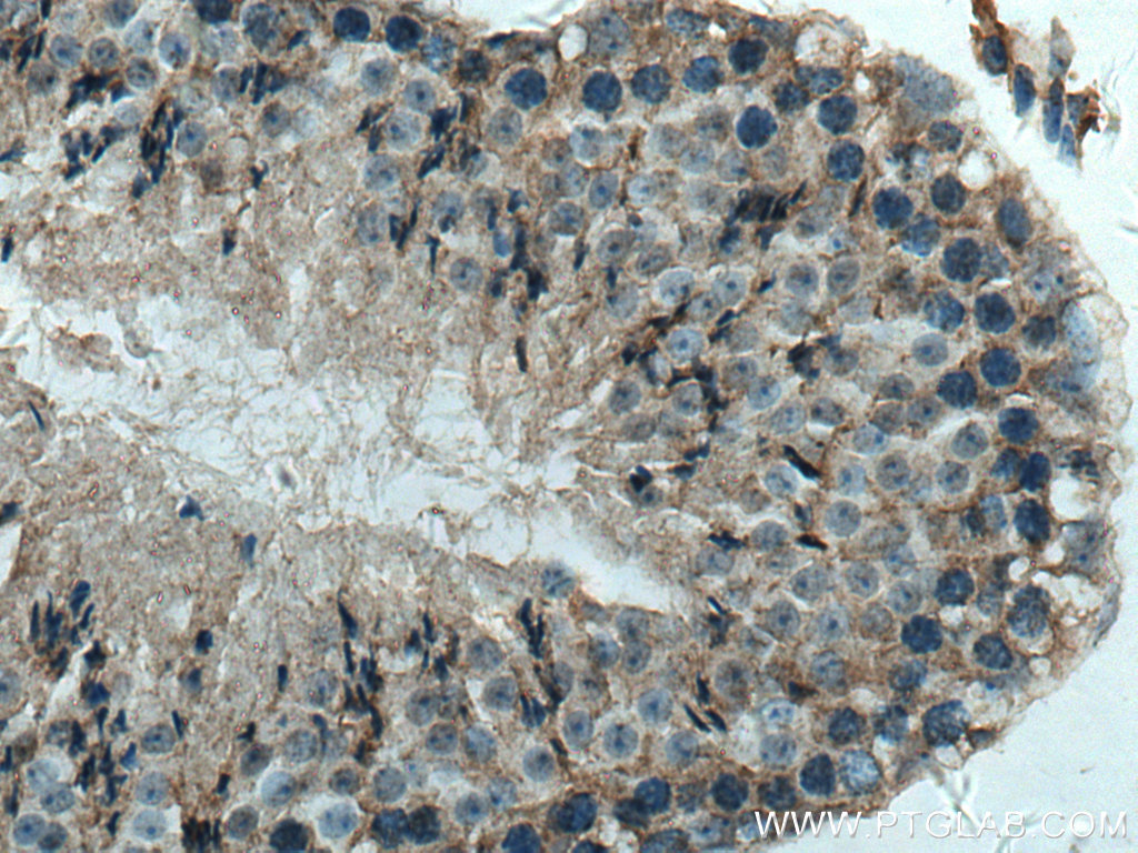 IHC staining of mouse testis using 24564-1-AP (same clone as 24564-1-PBS)