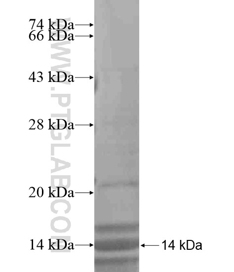 PCOTH fusion protein Ag20282 SDS-PAGE PCOTH fusion protein Ag20282 SDS-PAGE
