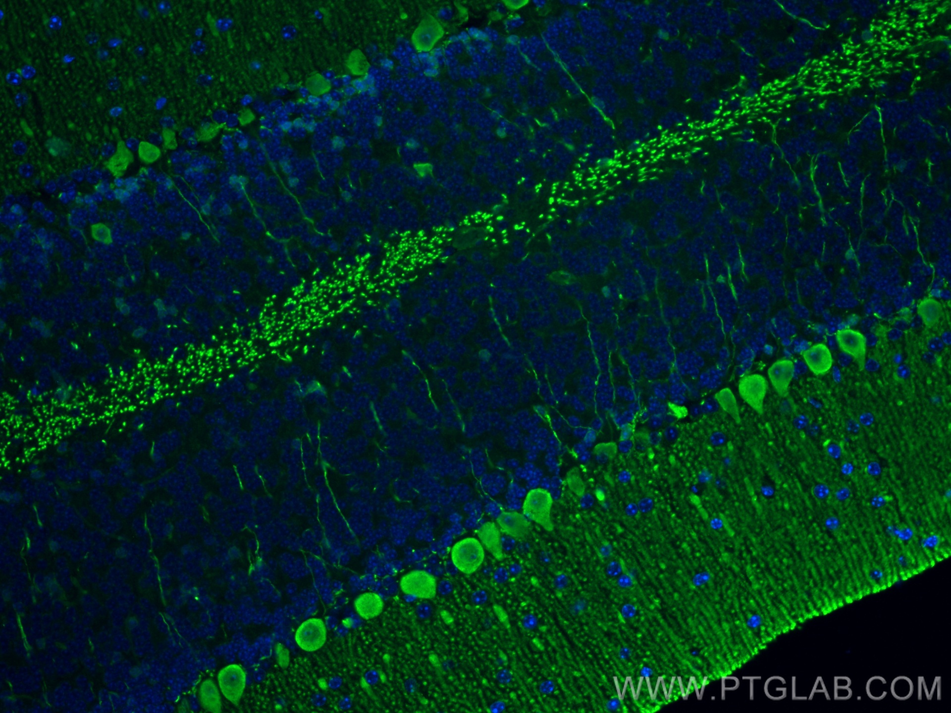 IF Staining of mouse cerebellum using 13774-1-AP