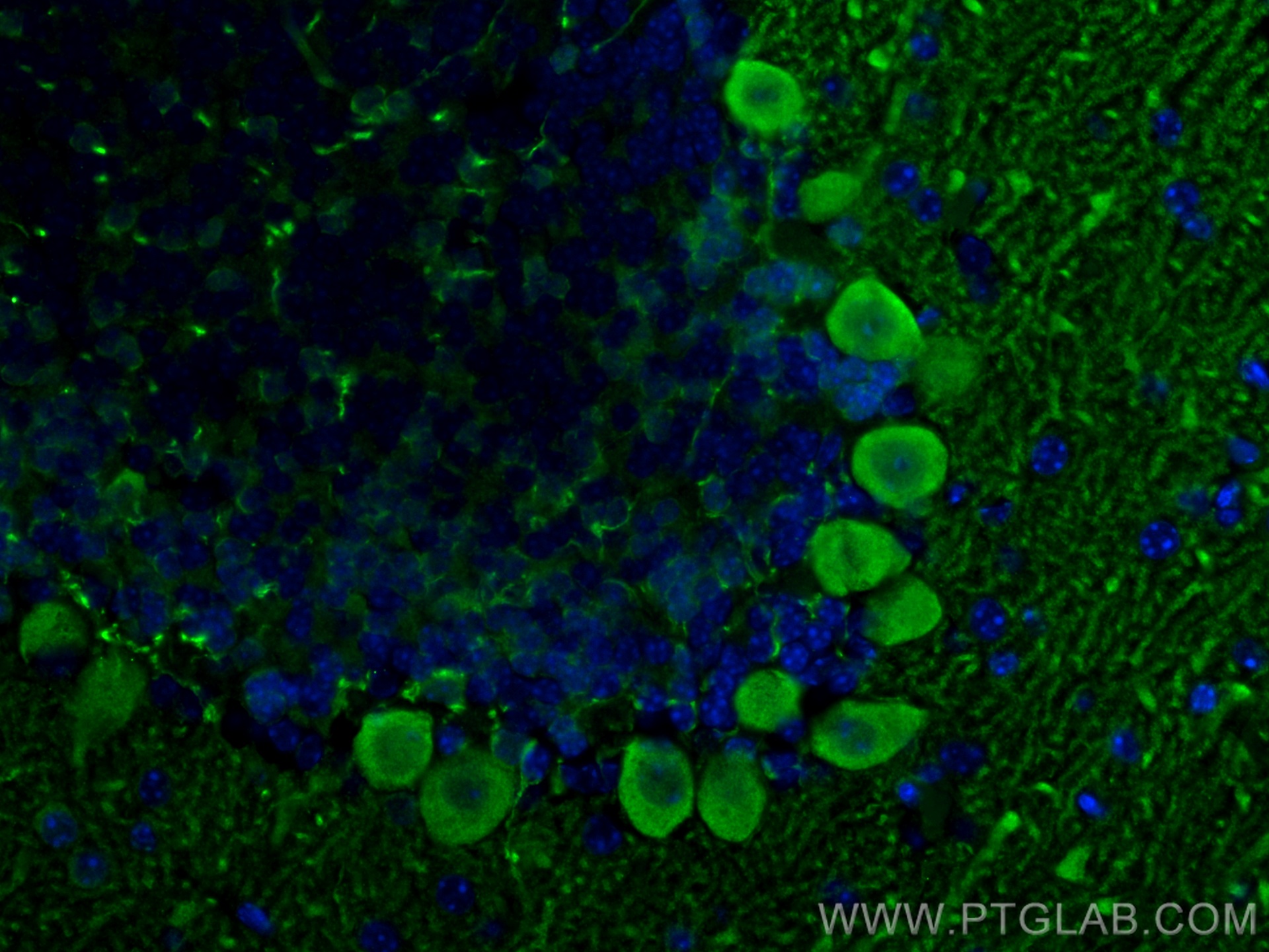 IF Staining of mouse cerebellum using 13774-1-AP