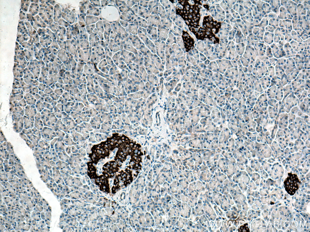 IHC staining of human pancreas using 28219-1-AP