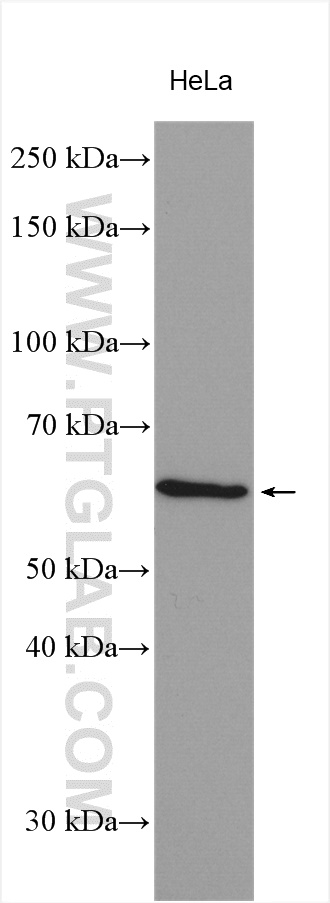 PCSK1