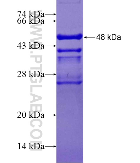 PCSK1 fusion protein Ag20063 SDS-PAGE PCSK1 fusion protein Ag20063 SDS-PAGE