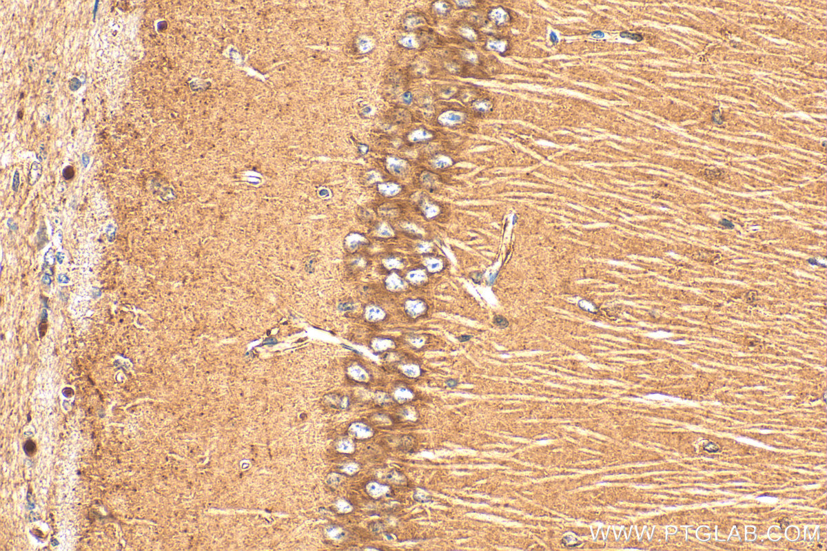 Immunohistochemical analysis of paraffin-embedded mouse brain tissue slide using 10553-1-AP (PCSK2 antibody) at dilution of 1:200 (under 40x lens). Heat mediated antigen retrieval with Tris-EDTA buffer (pH 9.0). IHC staining of mouse brain using 10553-1-AP