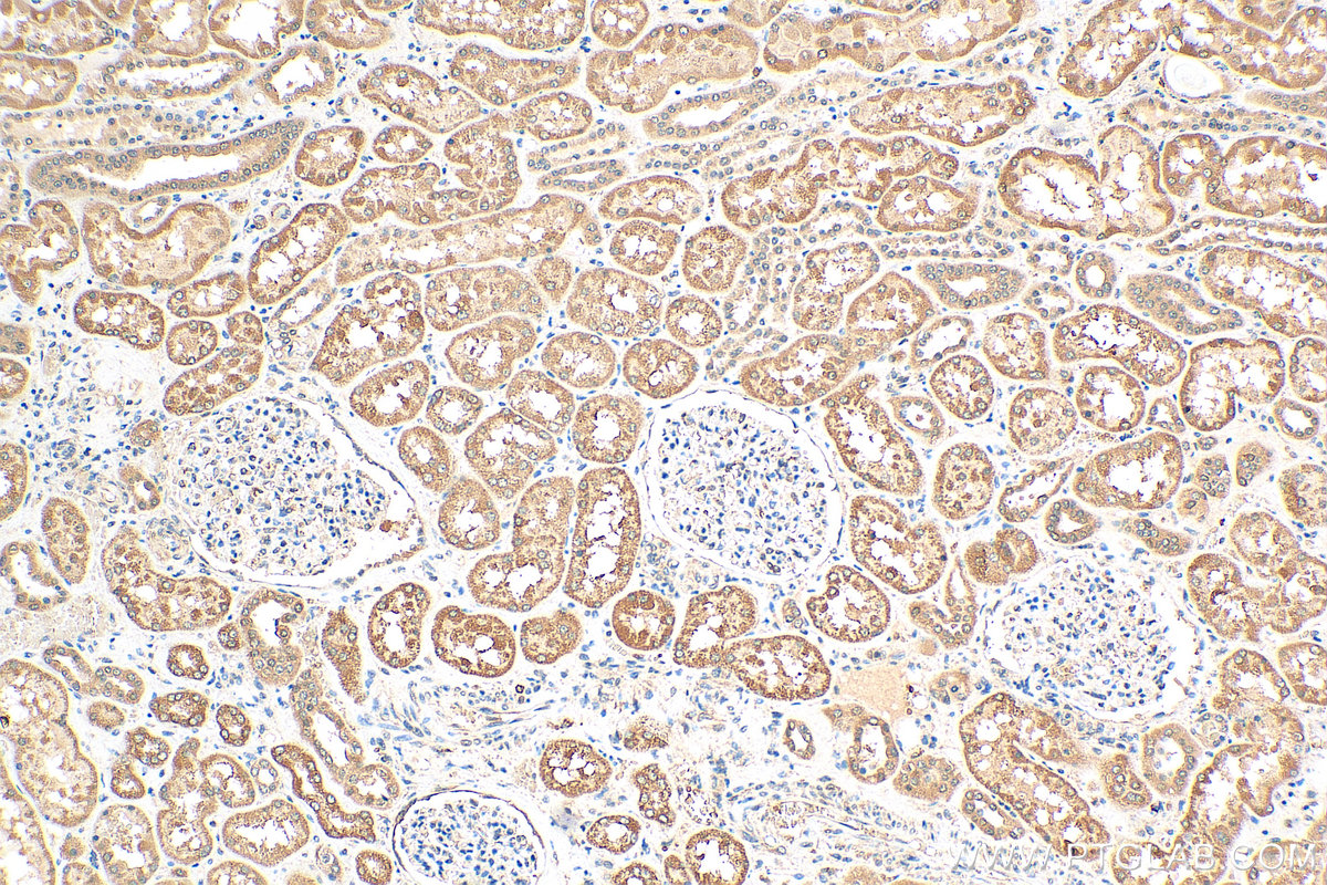 IHC staining of human kidney using 16470-1-AP