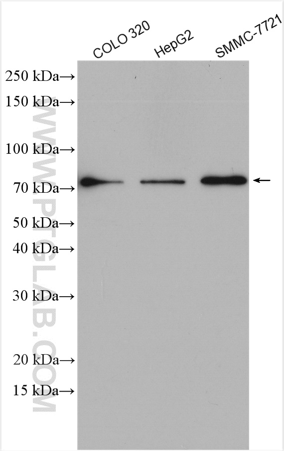 WB analysis using 55206-1-AP