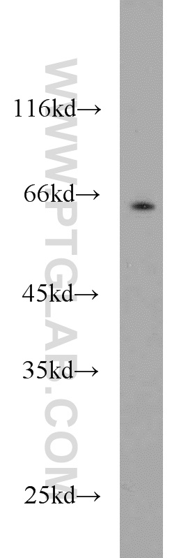 WB analysis of mouse brain using 10102-1-AP