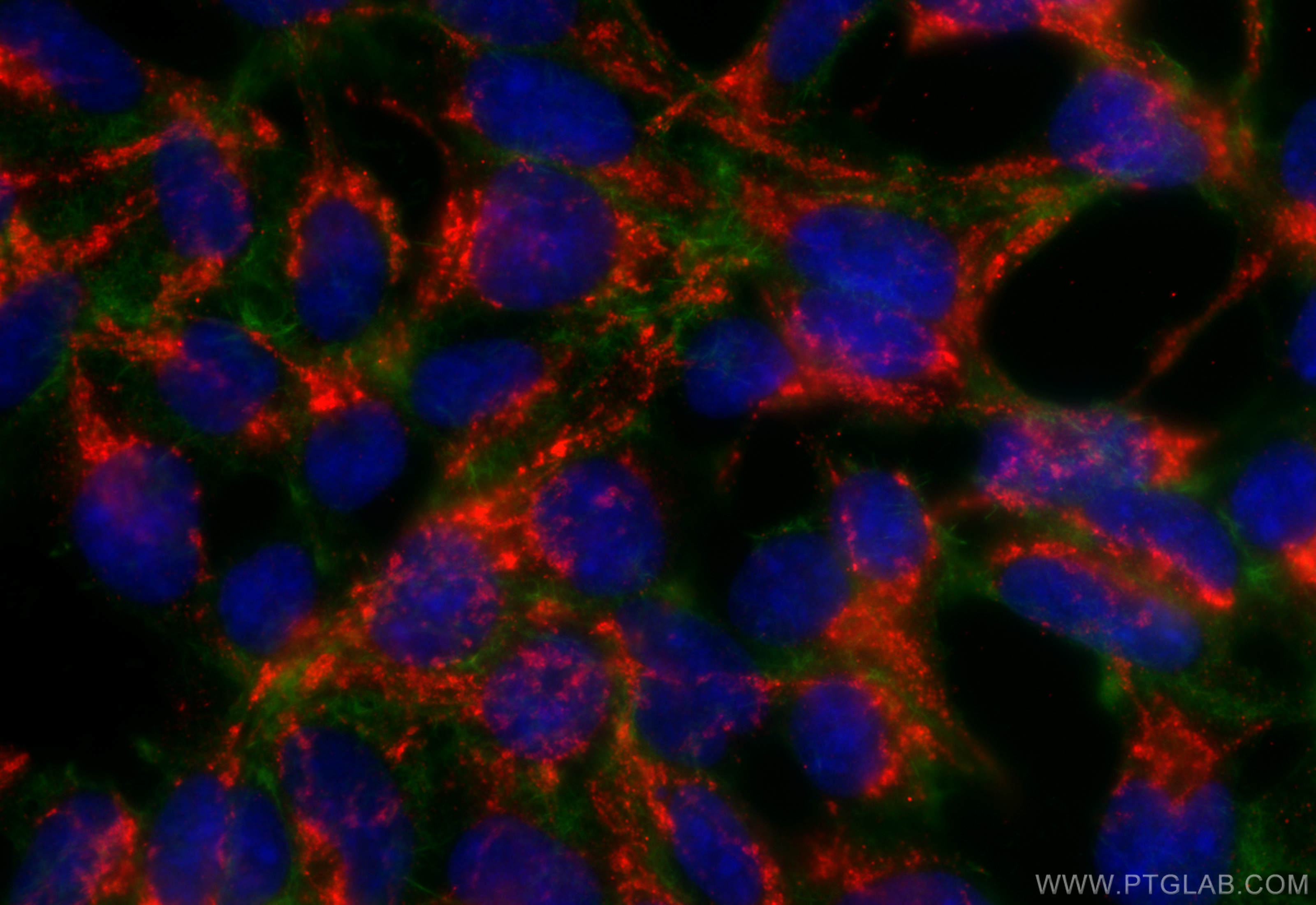 IF Staining of HEK-293 using 12207-1-AP