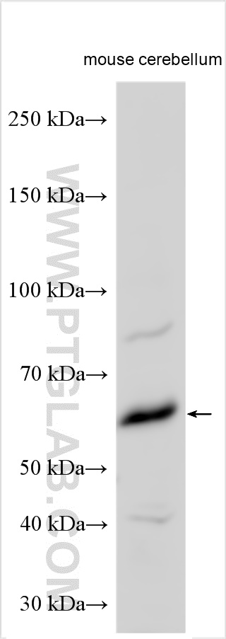 WB analysis using 30485-1-AP