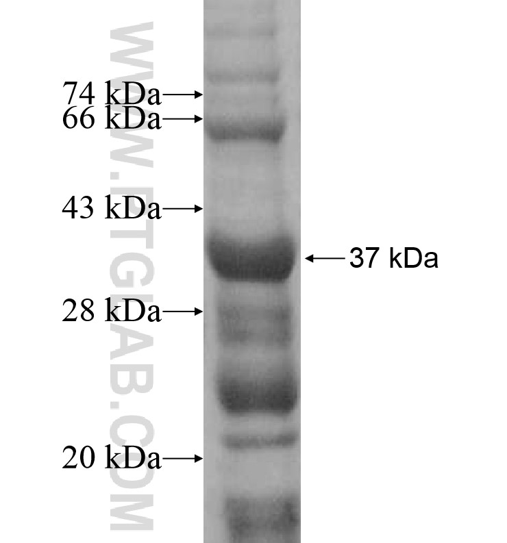 PCYOX1L fusion protein Ag16812 SDS-PAGE PCYOX1L fusion protein Ag16812 SDS-PAGE