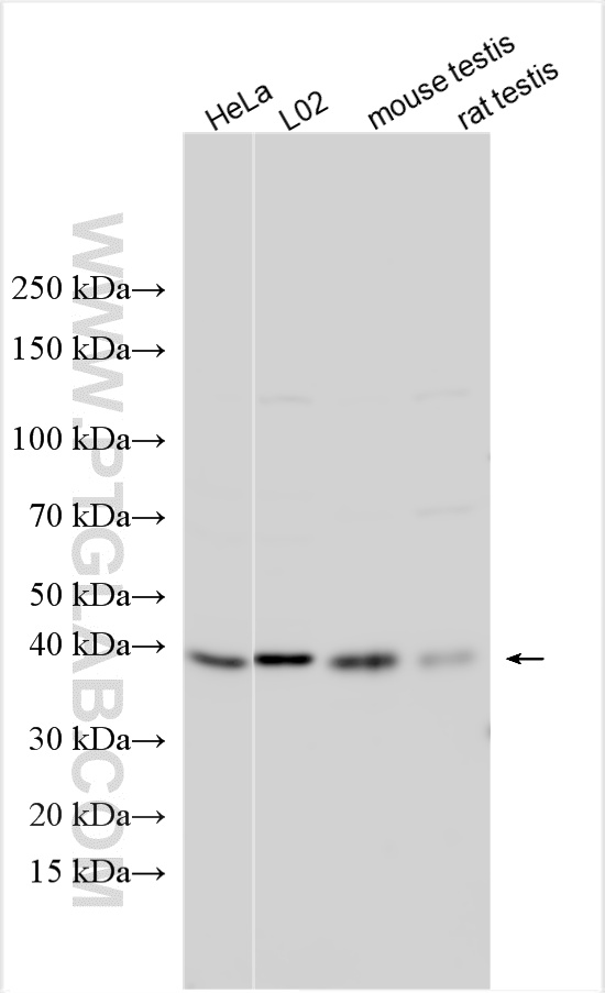 WB analysis using 30991-1-AP