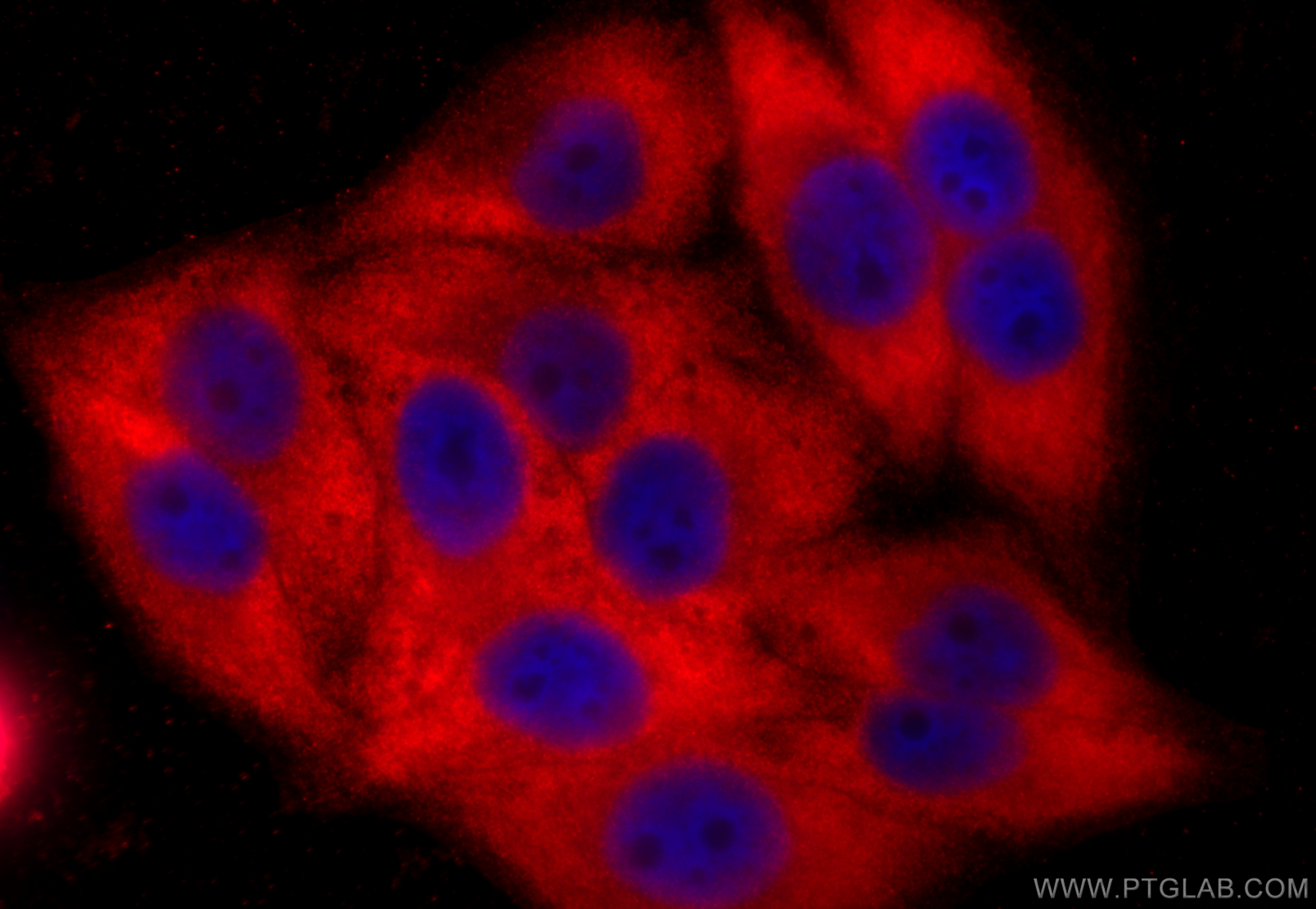 IF Staining of HepG2 using 14827-1-AP